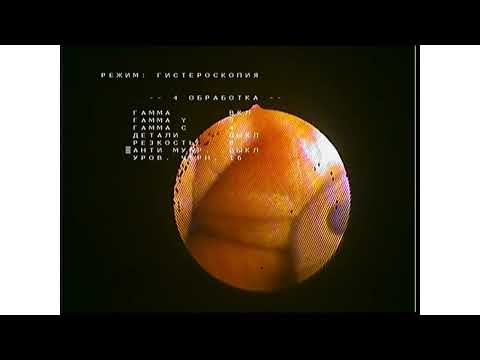 Видеокамера эндоскопическая "Элепс" EVK-001