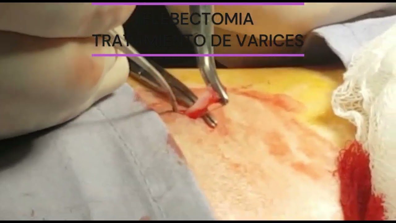 Marco Antonio Ayala García-18