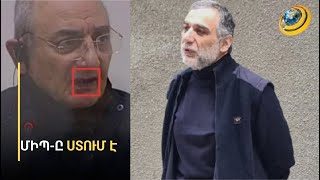 Կոտրված ատամնաշար, վերքեր ու հյուծված մարմին. Ադրբեջանում խոշտանգում են հայերին