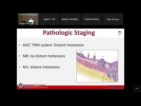 UW Urology Grand Rounds:  Muscle Invasive Bladder Cancer State of the Art – 9/7/2022