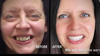 Stubbs Dental Television Ad 2021
