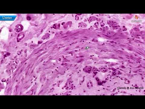 Histology of ureter: Shotgun Histology