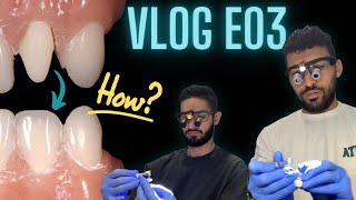 Mini Smile Makeover Course Vlog - Hardest skill to perfect? | ACE diploma Journey E03