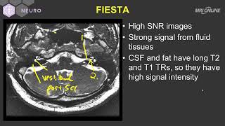 Download lagu Technique on MRI - Inner Ear MRI - Medality (MRI Online) Radiology Noon Conference mp3