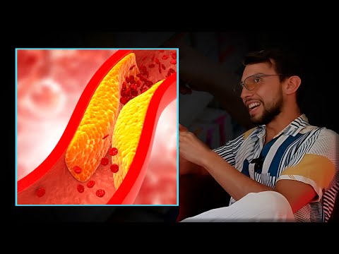 ¿El COLESTEROL te está MATANDO?