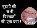 Homeopathic Medicine To Solve All The Problems Of Old Age Best Homeopathic Medicine For Old Aged