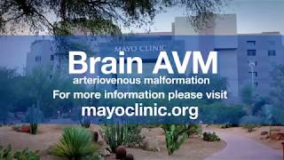 Dr. Bernard Bendok: Arteriovenous Malformation - Brain AVM