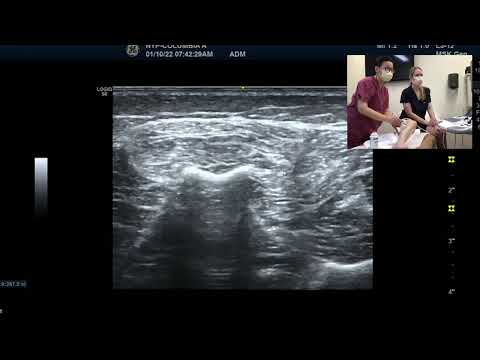 Lower Limb - distal leg muscles