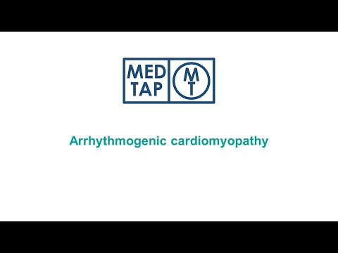 MedTap: Arrhythmogenic cardiomyopathy