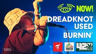 DreadKnot Used - “Burnin’” by Ini Kamoze (w/ Lyrics) - BMDM Irie Jam 3