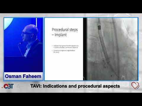 TAVI Indications and Procedural aspect by Osman Fahim