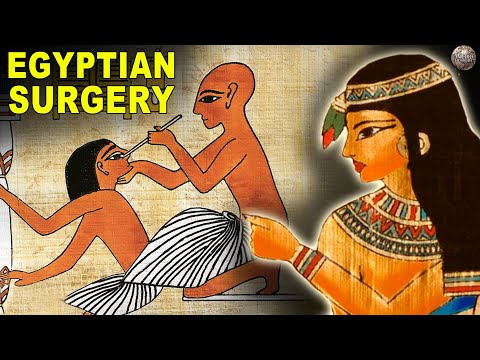 古代埃及的外科手术是什么样的（What Surgery Was Like In Ancient Egypt）