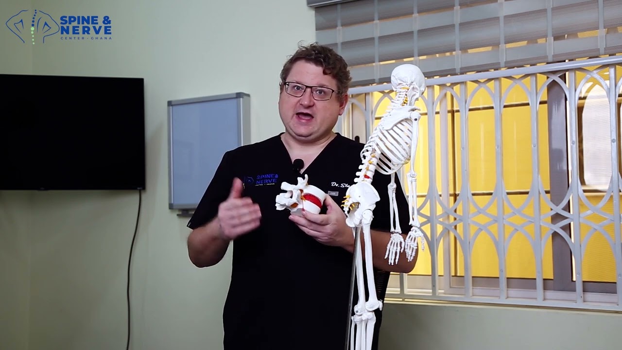 What is sciatica