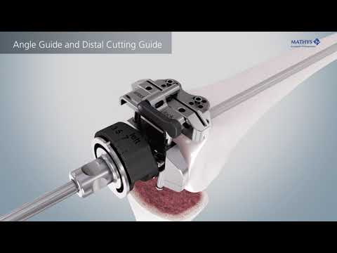 Mathys: balanSys BICONDYLAR leggera Instruments