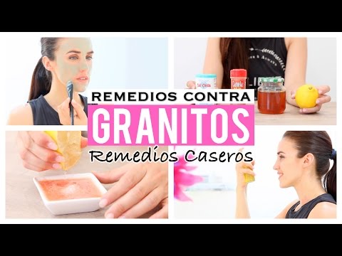 5 remedios caseros para eliminar los granitos