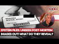 Epstein Files Unseen Post Mortem Images Out What Do They Reveal About His Last Minute Watch