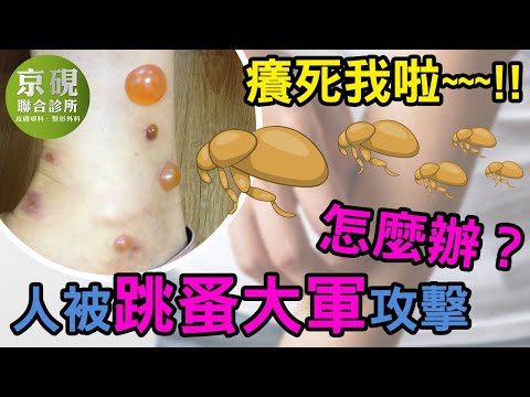 人被跳蚤大軍攻擊怎麼辦？癢死我啦~~~!!【京硯皮膚科診所】