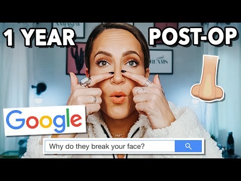 NOSE JOB 1 YEAR UPDATE: Was It Worth It?