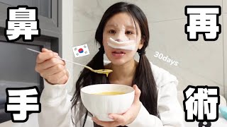 SNS休止期間中に韓国で鼻の再手術してました