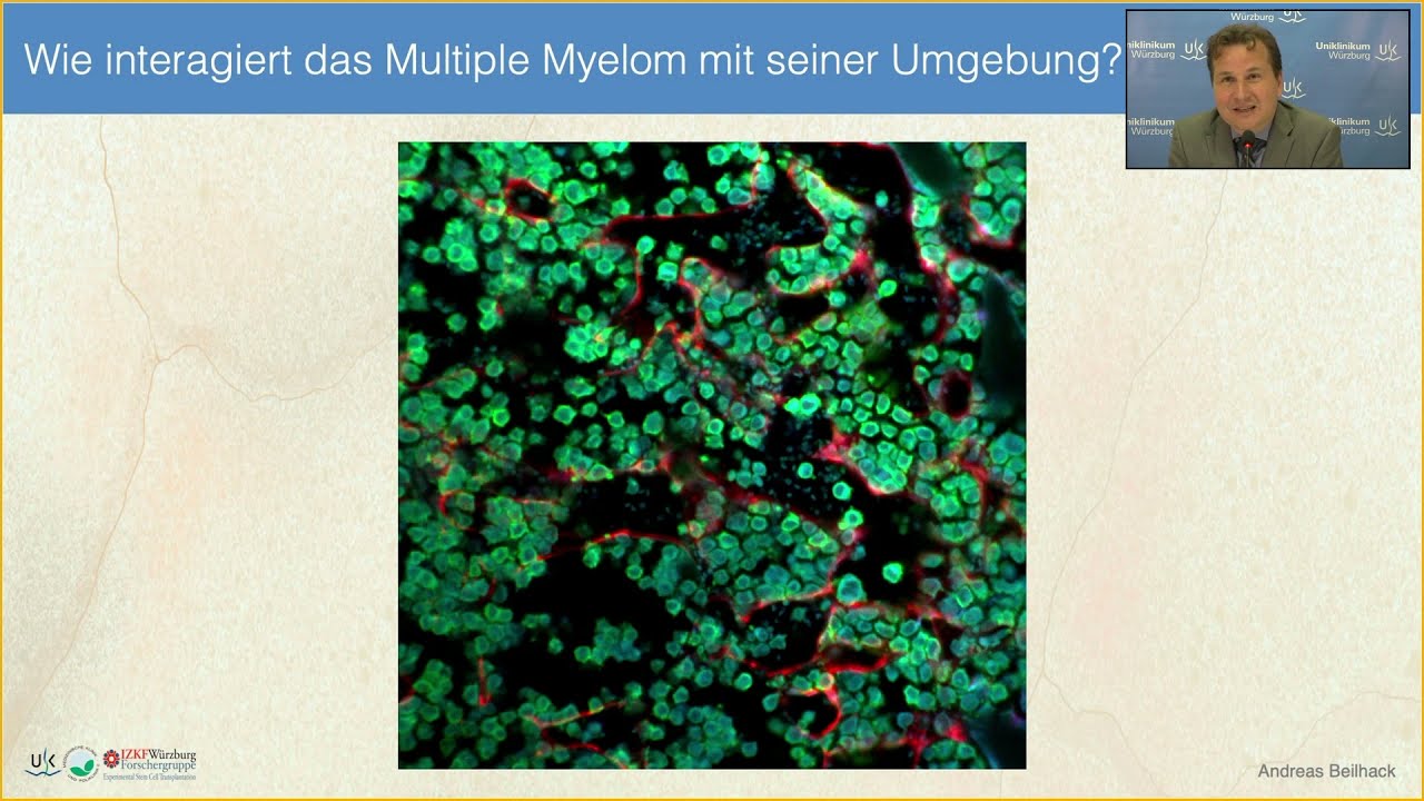 Neue Konzepte für die Myelomtherapie 2021