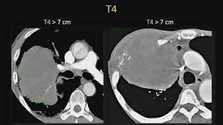 Radiology Case Review: Cardiothoracic Imaging - Sample