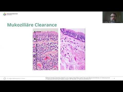 Management von Bronchiektasen: Aus ärztlicher Sicht (PARI-PhysioAssist Webinar 17.06.2021)