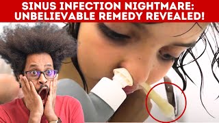 Spectacular Sinus Infection  - Must Watch
