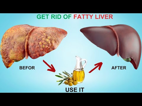 Top 6 vitamins to help clean FATTY LIVER | Healthy Care