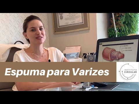 Tratamento de Varizes com Espuma: como funciona?