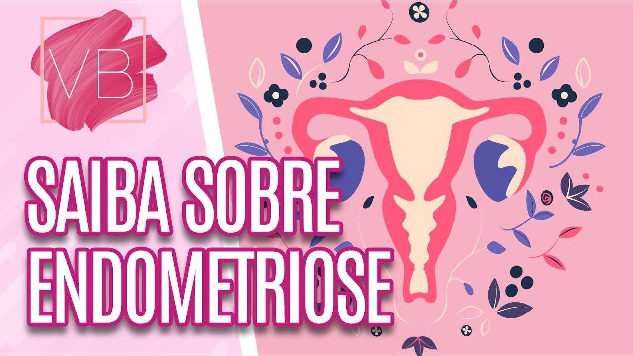 Entenda tudo sobre ENDOMETRIOSE - Você Bonita (19/03/2024)