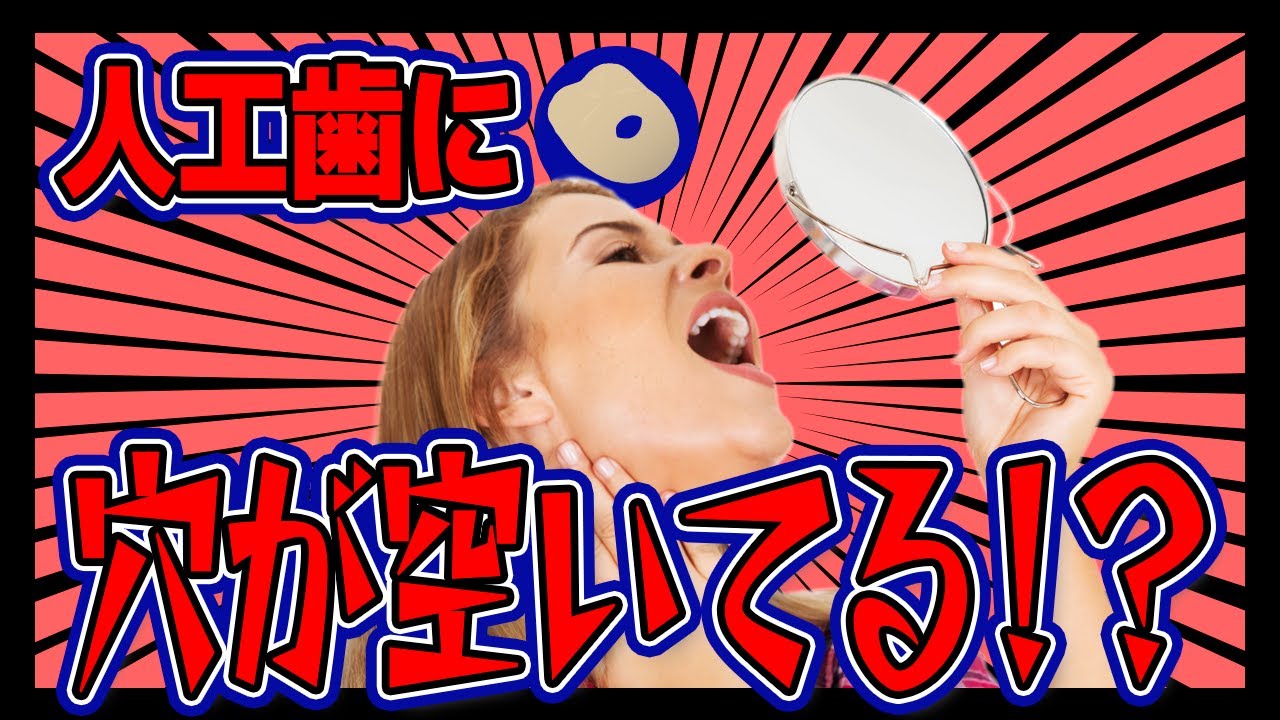 これって失敗?インプラントに穴が開いた!【アクセスホール】