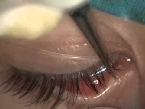 Leffetto di una faccia fa i bagagli da scarlatto La migliore raccolta della Corea affronta risposte di pacco