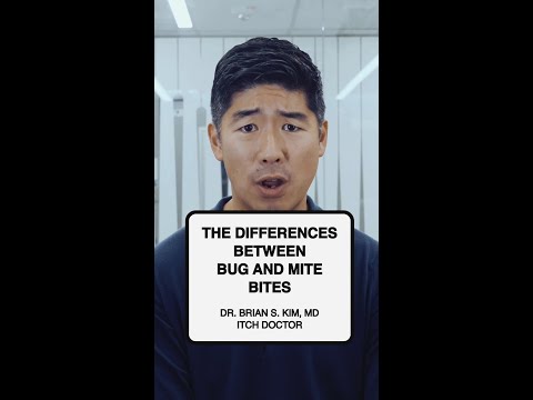 The Difference Between Bugs And Mite Bites
