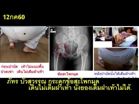 Tinctures โรคสะเก็ดเงินครีม การทดสอบกลากกับคำตอบ