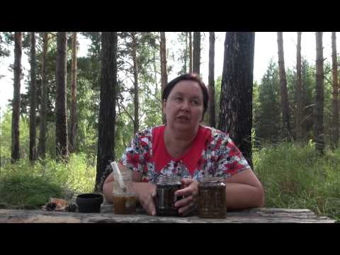Суставы теленка опухли суставы как лечить Тазобедренный сустав мышцы и связки анатомия