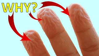 Why Does Your Skin, Fingers, Hands & Feet Wrinkle or Get Pruney in Water ?