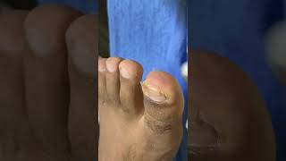 Ep_8295 Foot nails skin removal 👣 ดูแล้ว..จะใหญ่เบอร์ไหนดี 😄 (clip from Thailand)