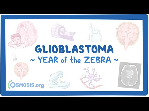 Glioblastoma (Year of the Zebra)