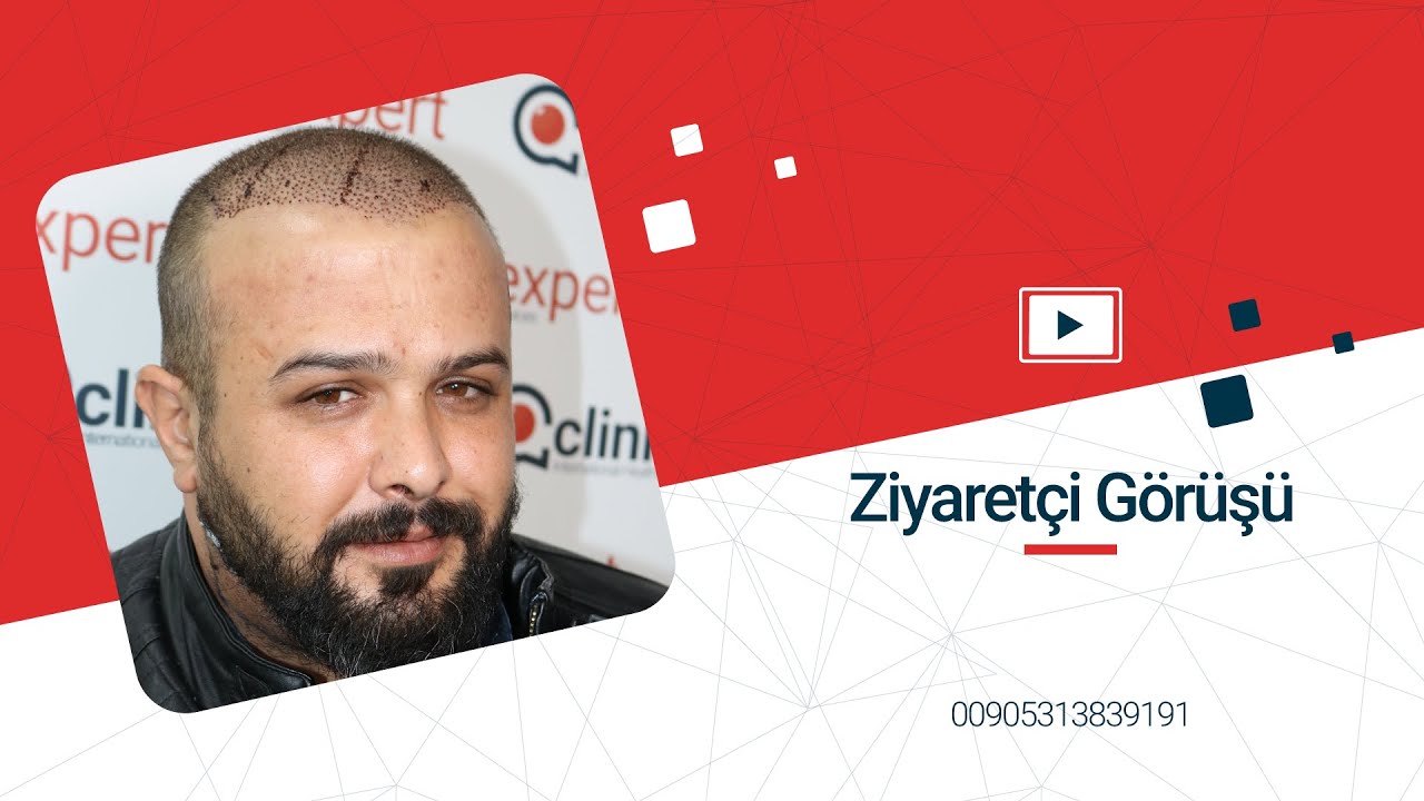 Saç Ekimi ve Estetik Cerrahi