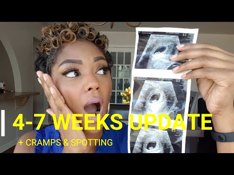 I'M PREGNANT!! My 4-7 WEEKS UPDATE + Spotting