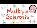 Multiple Sclerosis MS Symptoms Signs Risk Factors Diagnosis Treatment Autoimmune Neuro