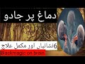 Demagh Pr Jadu 6 Nishanian Aur Qurani Ilaj Blackmagic RemovalQuran Rukiya Qurani Drhafiz Urdu Hindi