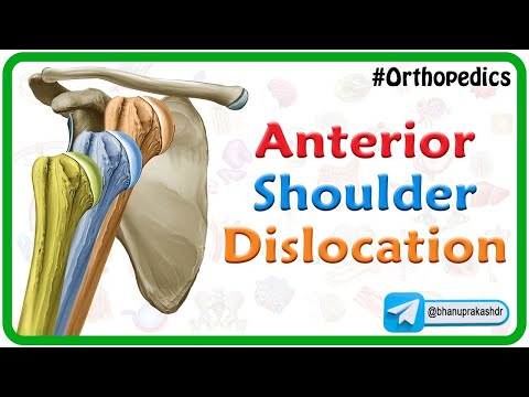Anterior shoulder dislocation Animation : Orthopedics Lecture / USMLE Step 1