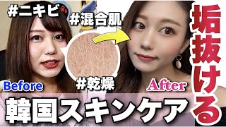 絶対に垢ぬける！ニキビ・毛穴・乾燥改善できる韓国で大人気のスキンケアブランドがヤバすぎる！【韓国コスメ】