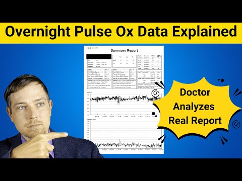 Overnight Pulse Ox Data For Sleep Apnea (Reviewed By Someone with a Medical Degree)