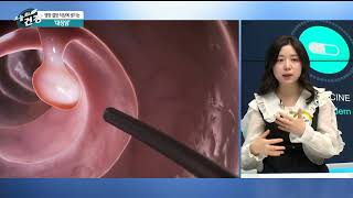 오늘의 건강_대장암(충북대병원 혈액종양내과 - 김희경 교수) 이미지