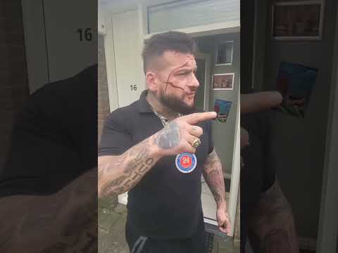 Popek zrobił skaryfikacje twarzy drugi raz !!!! #rap #popek #shorts