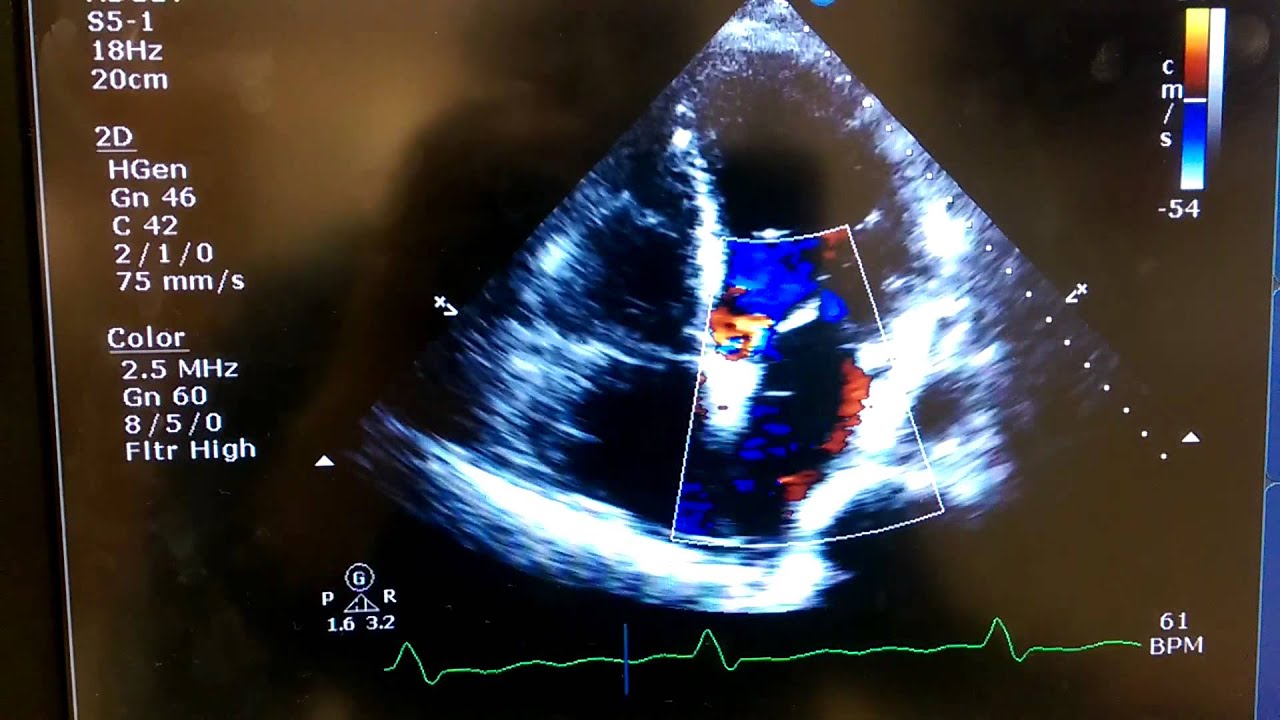 Robert echo case study 1