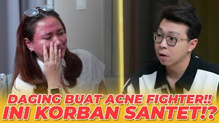 Download lagu WAJAH HANCUR!! KORBAN KLINIK KECANTIKAN INI!? PERNAH JADI BA!? mp3