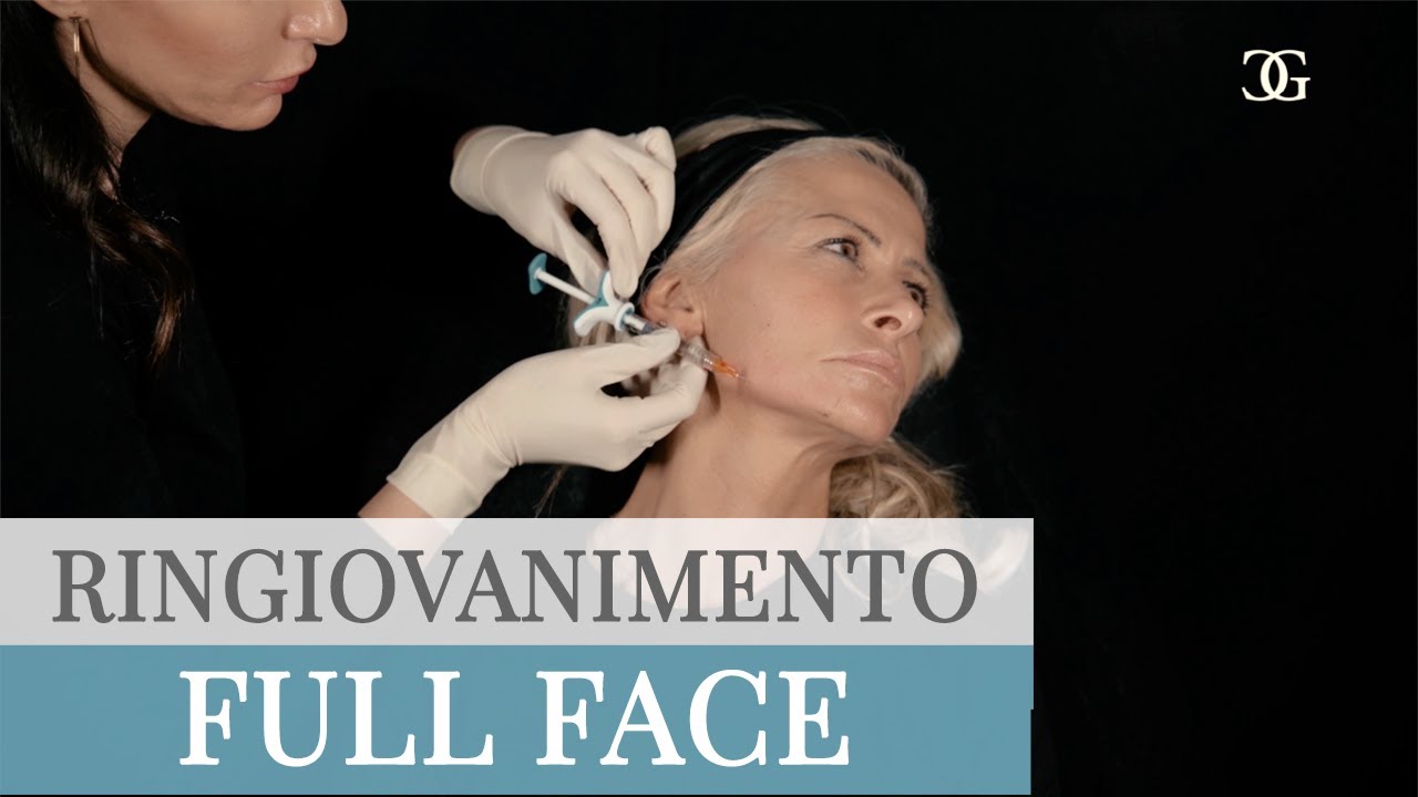 FULL FACE: Ringiovanimento Viso con FILLER e BOTULINO - Dr.ssa Beatrice Giorgini